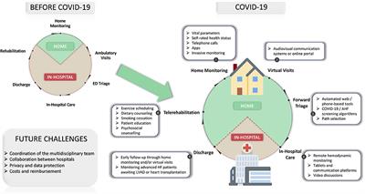 Telemedicine in Heart Failure During COVID-19: A Step Into the Future